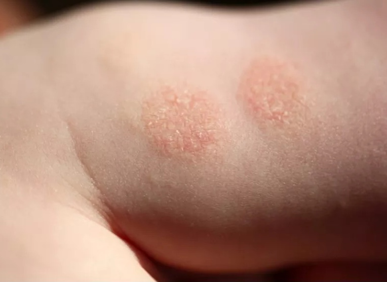 Nguoi-dan-ong-52-tuoi-ngay-nao-cung-nghi-ngo-vo-ngoai-tinh-di-kham-lo-ra-can-benh-mac-tu-20-nam-truo (1)