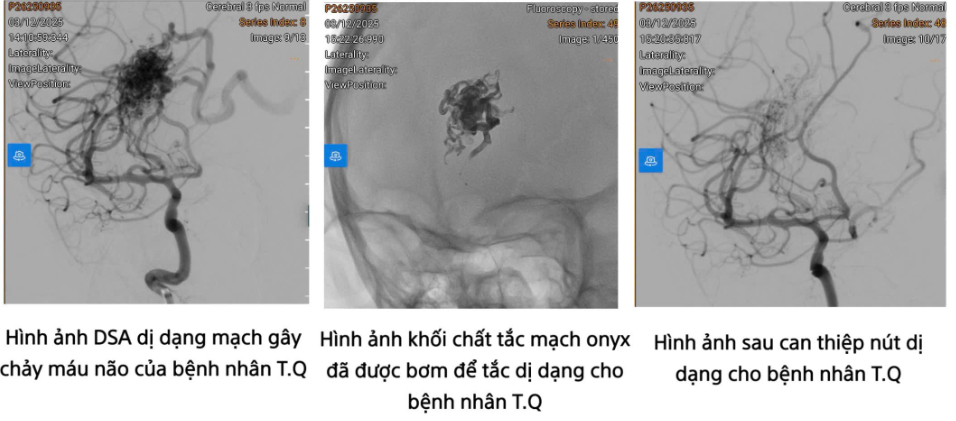 Ảnh: Bệnh viện 108