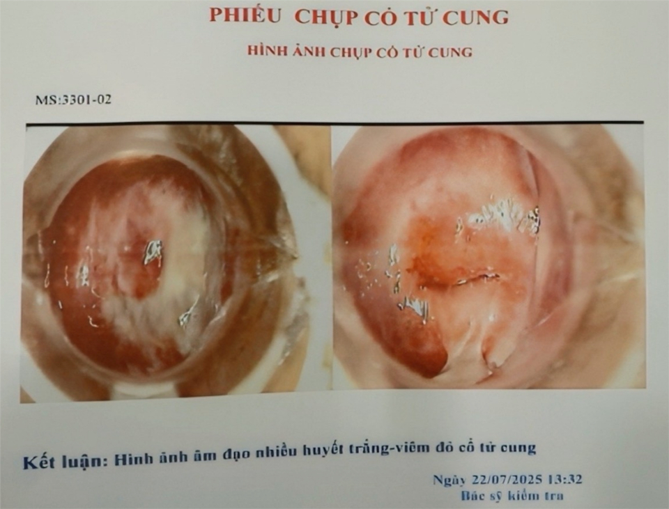 Hàng trăm hình ảnh chụp cổ tử cung bệnh lý, có mã số (ký hiệu MS) có sẵn trong máy tính của bác sĩ V.T.T. tại Phòng khám đa khoa của  Công ty TNHH Tập đoàn Việt Khang tại địa chỉ số 114 Trần Đình Xu, phường Cầu Ông Lãnh.