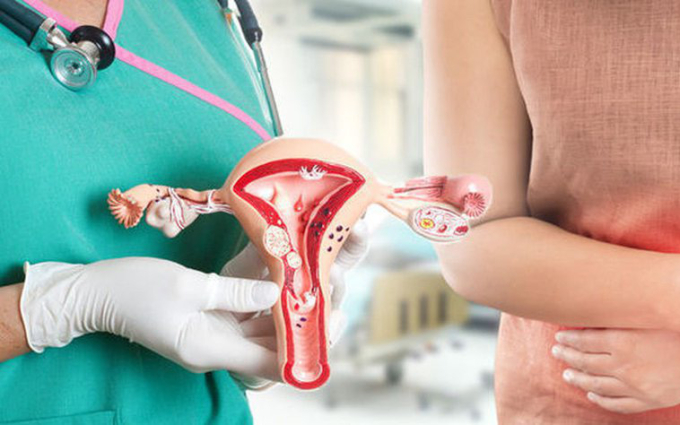 Nhiều chị em khốn khổ vì bị lạc nội mạc tử cung: Căn bệnh này nguy hiểm thế nào với phụ nữ?