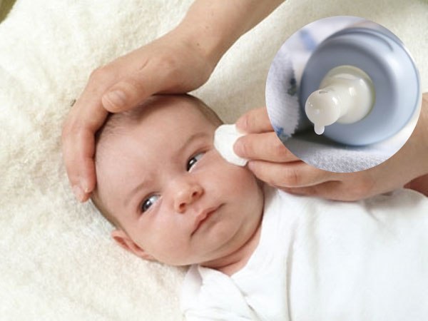 Nhỏ sữa mẹ vào mắt không thể chữa khỏi bệnh mà có thể khiến trẻ gặp phải các vấn đề về mắt nguy hiểm hơn. Hình minh họa.