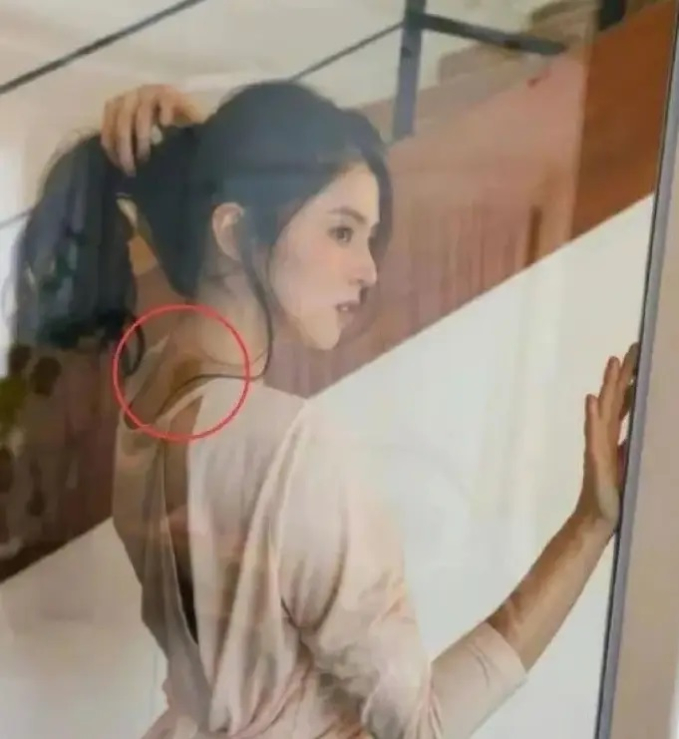 Gáy của Han So Hee cũng lộ vết bầm tím