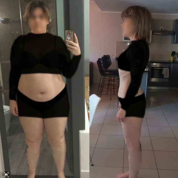 Hình ảnh của chị Kristy Anne Smith trước và 3 năm sau khi phẫu thuật cắt tạo hình dạ dày (Ảnh: NVCC)