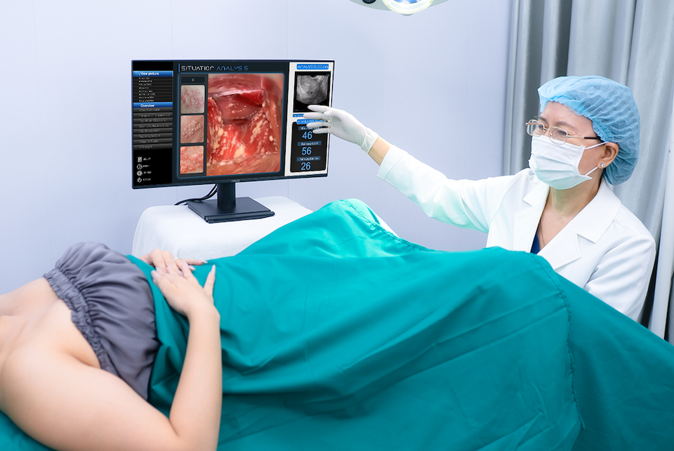 Sử dụng hệ thống nội soi hiện đại giúp bác sĩ và bệnh nhân cùng quan sát trực tiếp tình trạng niêm mạc cổ tử cung.