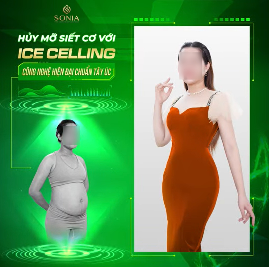 Hình ảnh quảng cáo trên Facebook của cơ sở, sử dụng ảnh “trước - sau” của một phụ nữ được giới thiệu là thay đổi vòng bụng sau khi áp dụng liệu trình giảm béo bằng công nghệ “huỷ mỡ siết cơ Ice Celling”.