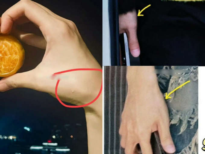 Đáng chú ý, sau khi đối chiếu với ảnh Đặng Vi, 1 blogger xứ Trung cho rằng bàn tay bên trái là của nam thần họ Đặng dựa vào vị trí nốt mụn, độ dài ngón tay...