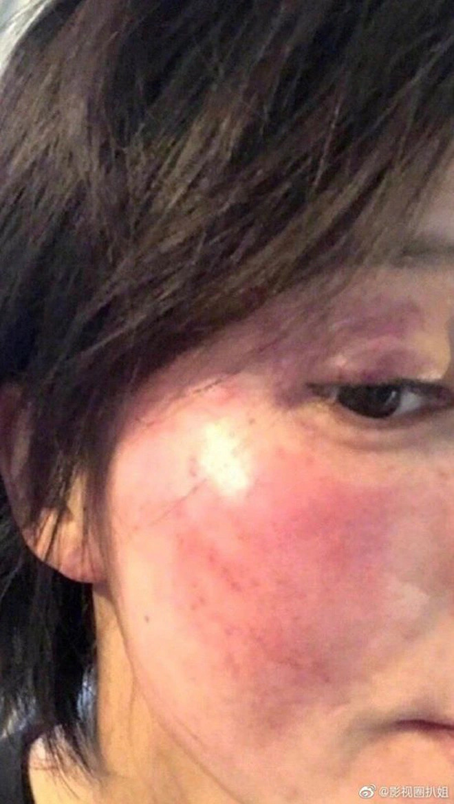 Hoàng Cảnh Du bị tố bạo hành vợ cũ hồi năm 2018, khiến cộng đồng mạng không khỏi choáng váng