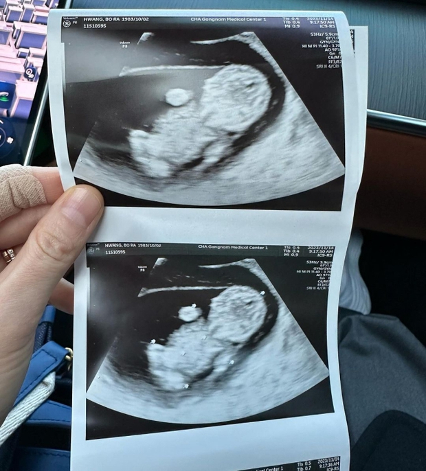 Đến tháng 11 năm nay, cô vui mừng thông báo đang mang thai con đầu lòng sau 4 lần thụ tinh ống nghiệm