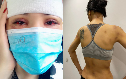 Khả Trang bị tụ máu ở mắt, cơ thể chi chít vết thương do bị bạo hành 