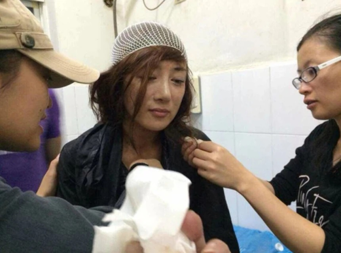   Lý Y Hiểu đau đớn chịu cảnh thương tích nặng nề sau khi bị chó cắn. Nữ diễn viên bị rách nhiều vết ở tai, đầu, mặt và phải khâu hơn 20 mũi  