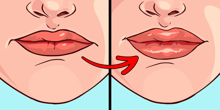 Chỉ bằng cách nhìn vào đôi môi, bạn có thể biết được tình trạng sức khỏe