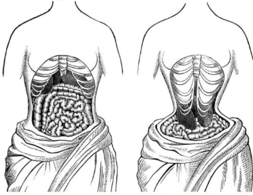 Quấn đai nịt bụng khiến cấu trúc xương sườn, chúng sẽ siết chặt phổi, khiến thể tích khoang bụng cũng bị thu hẹp.
