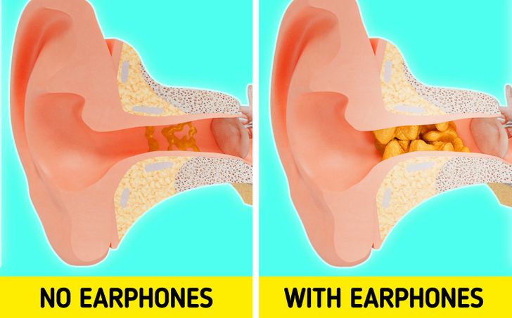Điều gì sẽ xảy ra với cơ thể khi bạn đeo tai nghe quá lâu?