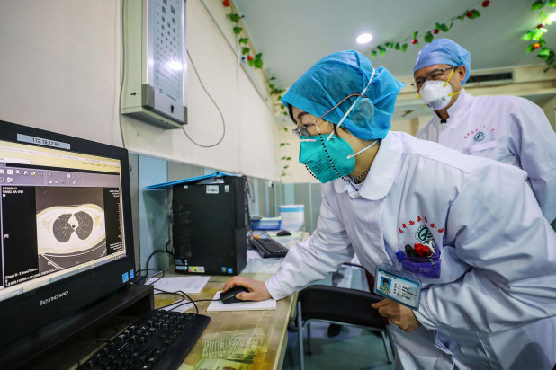 Một bác sĩ xem ảnh chụp CT phổi ở Vũ Hán. Ảnh: AFP