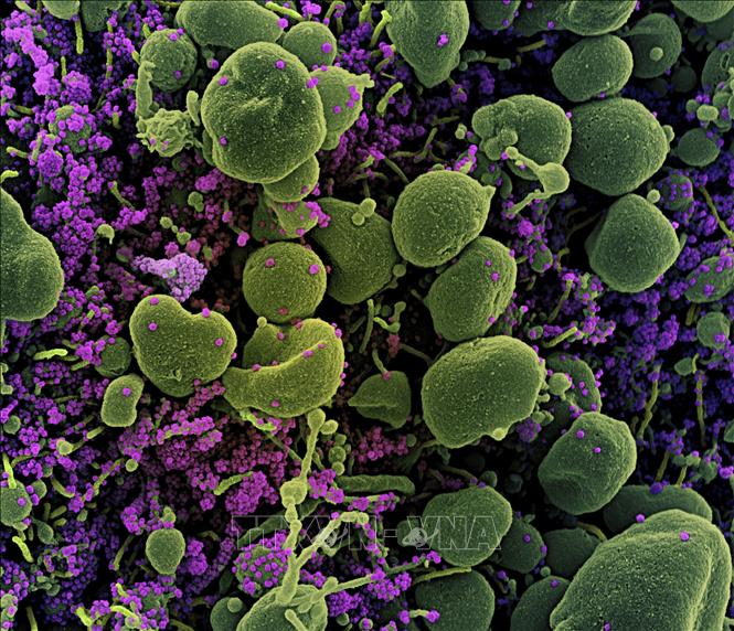   Hình ảnh quét qua kính hiển vi điện tử cho thấy một tế bào (màu xanh) bị virus SARS-COV-2 (màu tím) xâm nhập, lấy từ mẫu bệnh phẩm của bệnh nhân COVID-19 tại Viện Nghiên cứu Dị ứng và Bệnh Truyền nhiễm Quốc gia, Fort Detrick, Maryland, Mỹ. Ảnh minh họa: AFP/TTXVN  