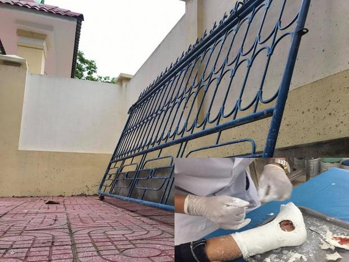 Vụ sập cổng làm 3 học sinh bị thương ở Nghệ An. Ảnh: Báo Giao thông