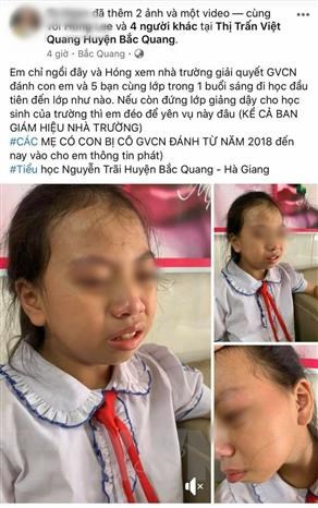  Hình ảnh nữ học sinh lớp 4 Trường Tiểu học Nguyễn Trãi, huyện Bắc Quang (Hà Giang) bị giáo viên tát vào má được người nhà học sinh đưa lên mạng xã hội. Ảnh: TTXVN