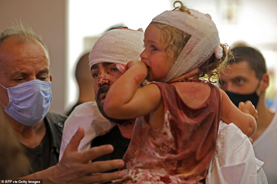 Vụ nổ khiến hàng trăm người thương vong ở Beirut đêm qua, họ được điều trị tại bệnh viện.