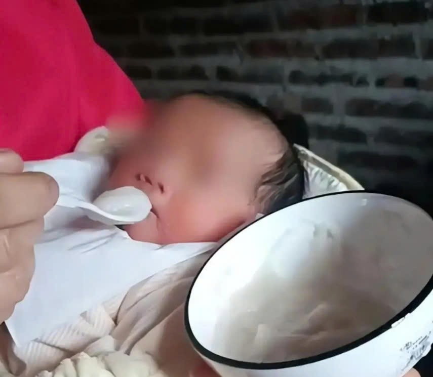 Sỏi thận ở bé 5 tháng tuổi, lời cảnh tỉnh đau lòng về sai lầm nuôi con truyền thống
