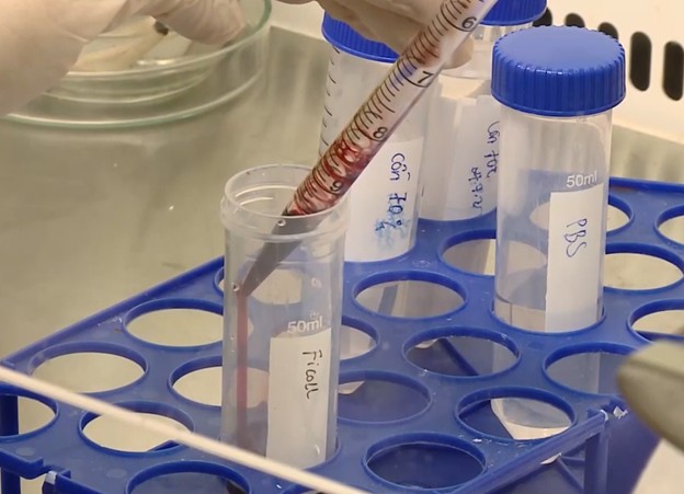 Thí nghiệm tách tế bào đơn nhân tủy xương để phân lập tế bào gốc CD34