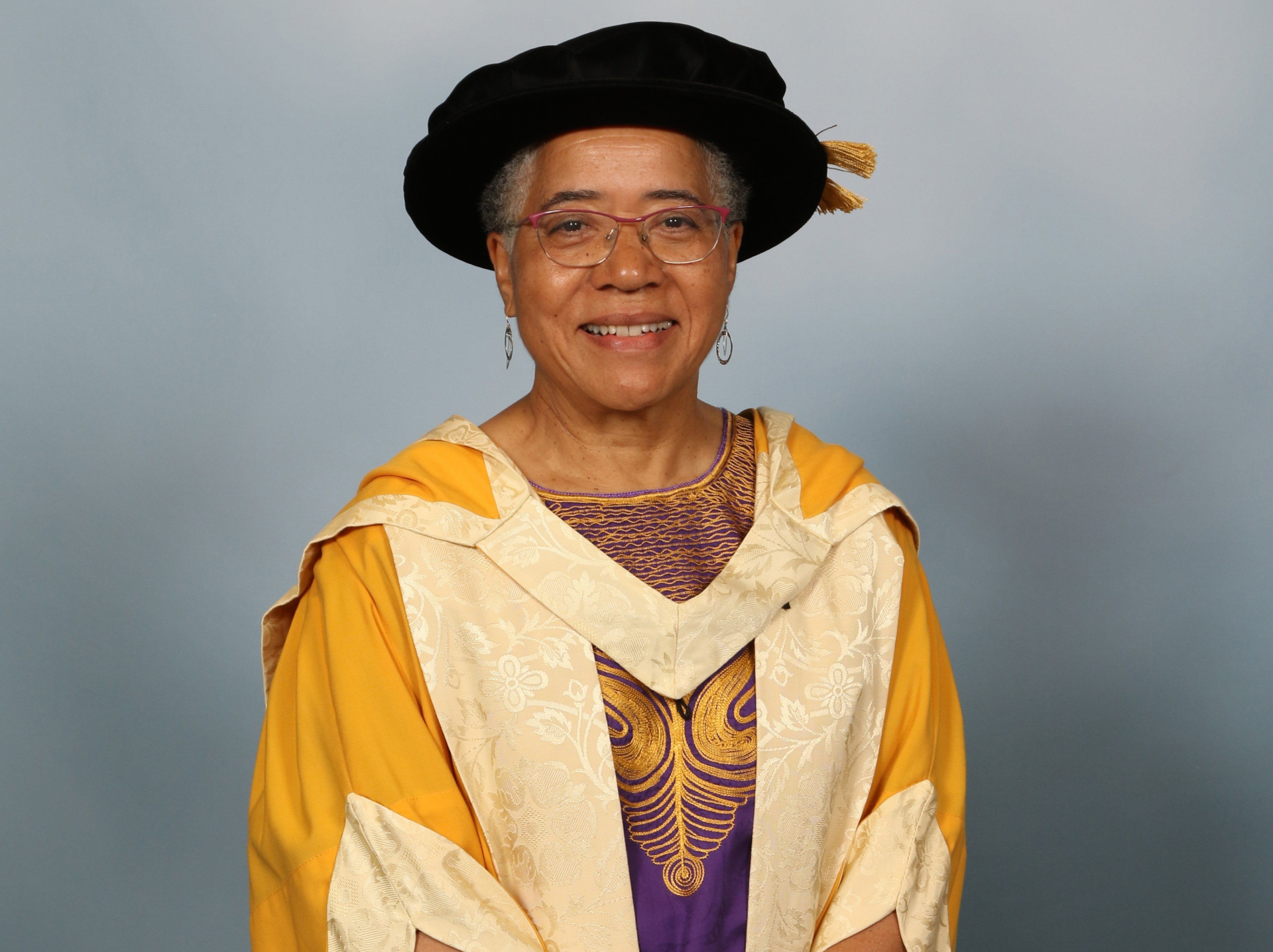 Dame Elizabeth Anionwu: Người đặt nền móng cho mô hình chăm sóc bệnh hồng cầu hình liềm tại Anh