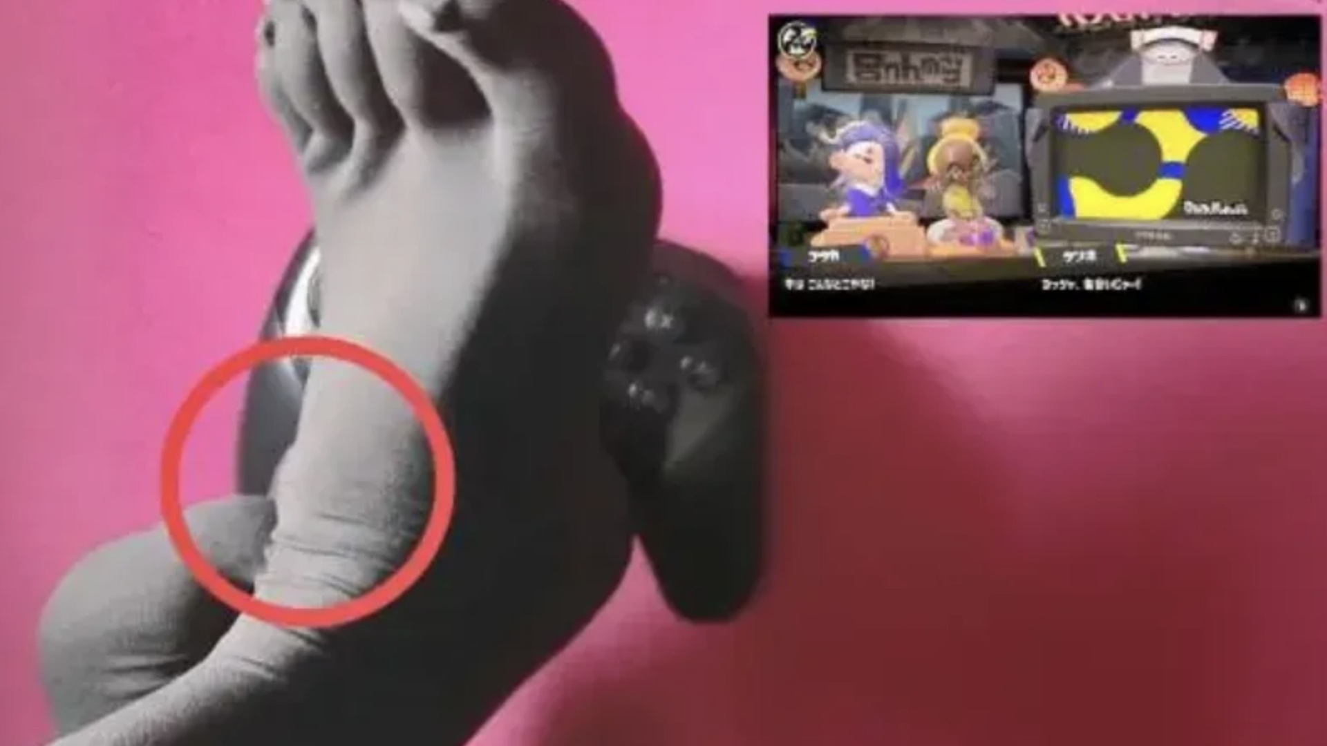 1800 ngày chơi game bằng chân, cơ thể nữ streamer biến dạng kinh hoàng