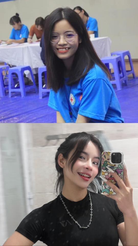 Công khai hình ảnh trước khi 