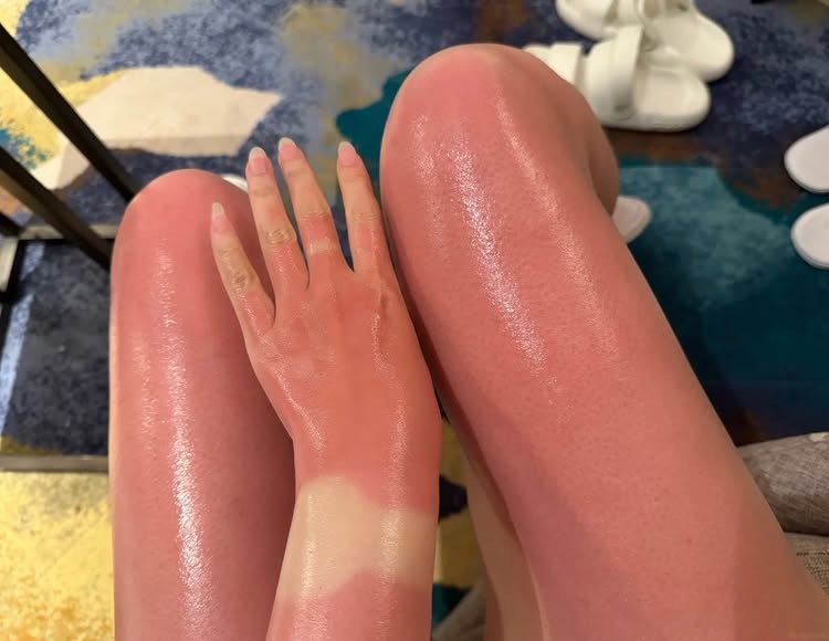 Phía sau những màn chạy đua khoe đường cong mãn nhãn của hội chị em