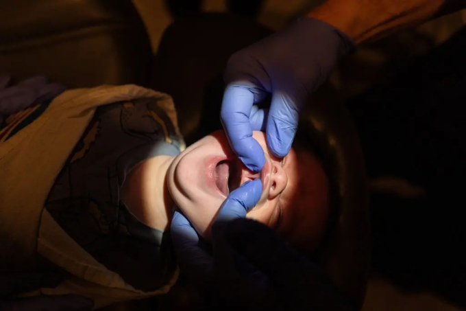 Thủ thuật cắt thắng lưỡi cho trẻ đang bị lạm dụng một cách vô tội vạ?