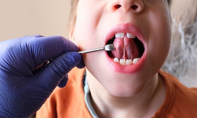 Các nha sĩ thực hiện thủ thuật này thường sử dụng tia laser để cắt phần mô nối lưỡi với đáy miệng.