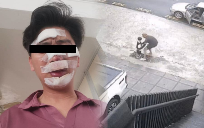 Bức ảnh anh Lin bị thương nặng sau khi giải cứu con trai khỏi bị bắt cóc nhanh chóng lan truyền trên mạng xã hội. 