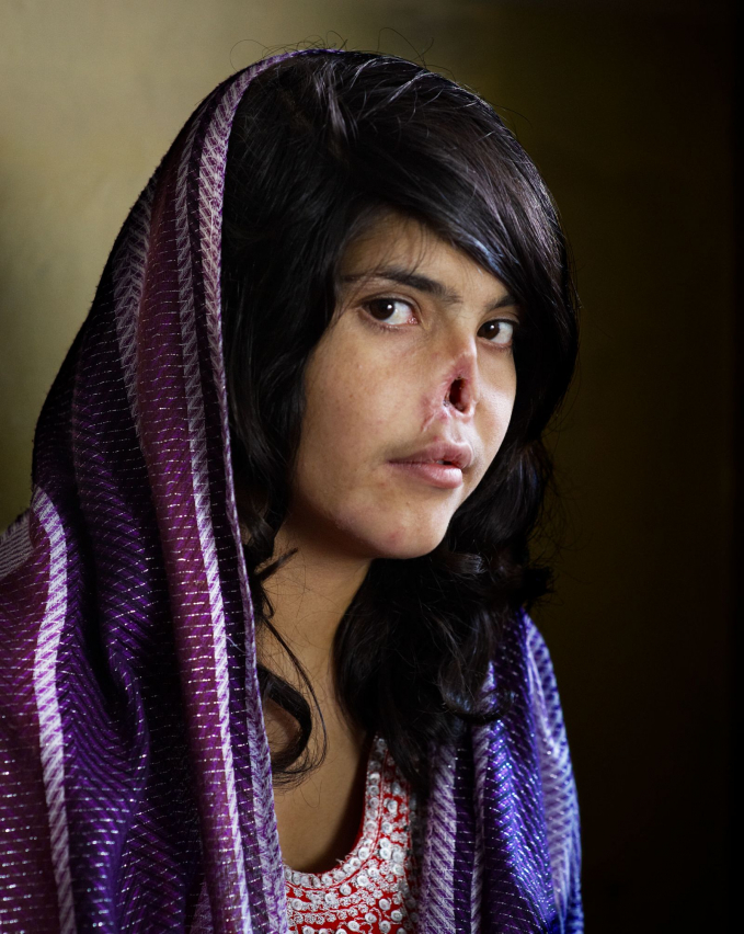 Bức ảnh này của người phụ nữ Afghanistan Aesha Mohammadzai xuất hiện trên trang bìa của tạp chí Time vào tháng 8 năm 2010. Người chồng và người chồng Taliban của cô đã trừng phạt cô vì bỏ trốn bằng cách đâm vào mũi và tai và bỏ mặc cô ta cho đến chết. Cô trở thành một biểu tượng cho sự áp bức của phụ nữ ở đất nước bị chiến tranh tàn phá. Cô đã bay đến Hoa Kỳ, nơi cô đã trải qua nhiều cuộc phẫu thuật để tái tạo lại mũi.