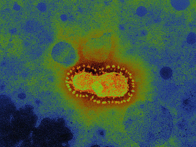 Hình dạng của virus corona Vũ Hán.