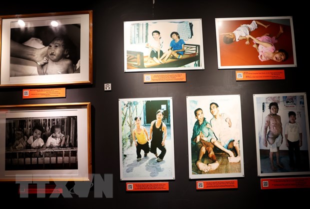 Hình ảnh về các nạn nhân da cam ở Việt Nam. (Ảnh: Hồng Đạt/TTXVN)