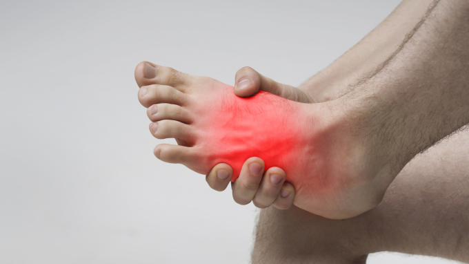 Dấu hiệu bất thường ở bàn chân có thể cảnh báo bệnh tim hoặc tiểu đường (Ảnh: iStock) 