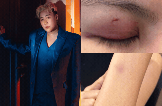 Công an vào cuộc xác minh vụ bài viết trên mạng xã hội Facebook tố ca sĩ Trung Quân idol đánh người