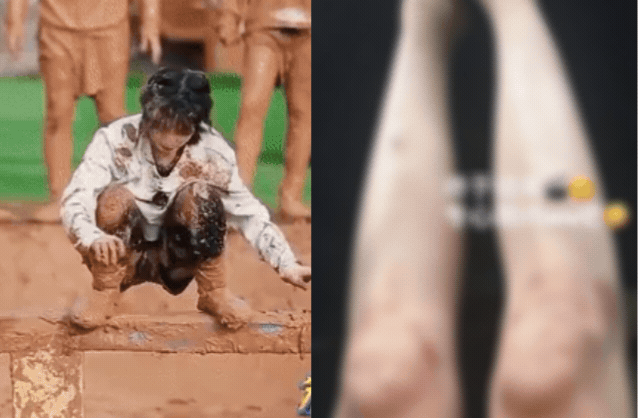 Đôi chân không ai dám nhìn vào của ngọc nữ Running Man đang vướng tin hẹn hò 'trai hư lắm phốt' làm cả nước xôn xao