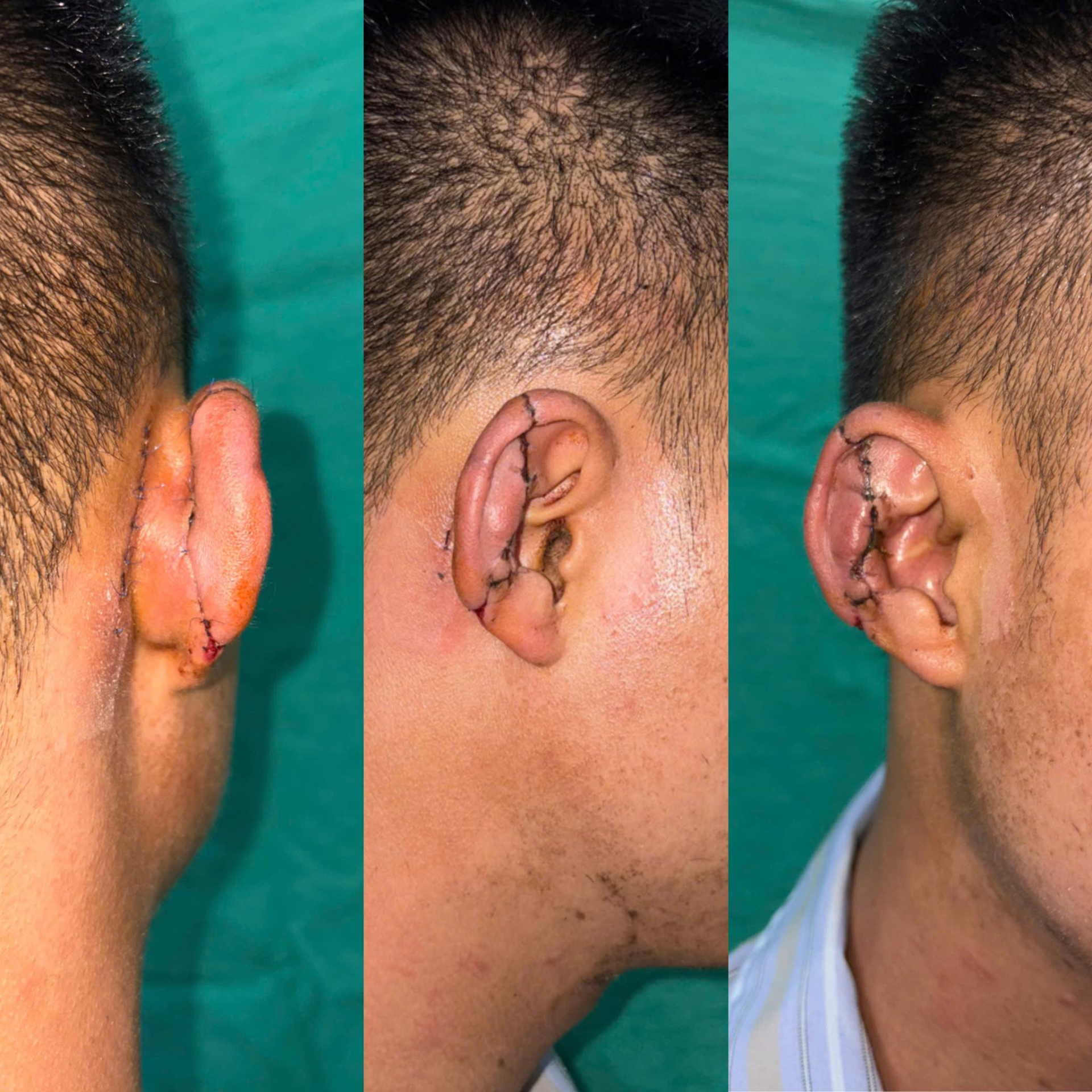 Ảnh: Bệnh viện Nhiệt đới trung ương