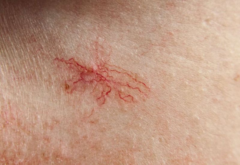 Muốn biết gan khỏe hay yếu, chỉ cần nhìn vào làn da sẽ rõ: Có 5 dấu hiệu này phải đi khám ngay