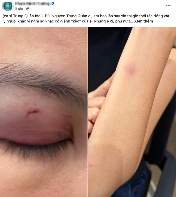 Ảnh chụp màn hình