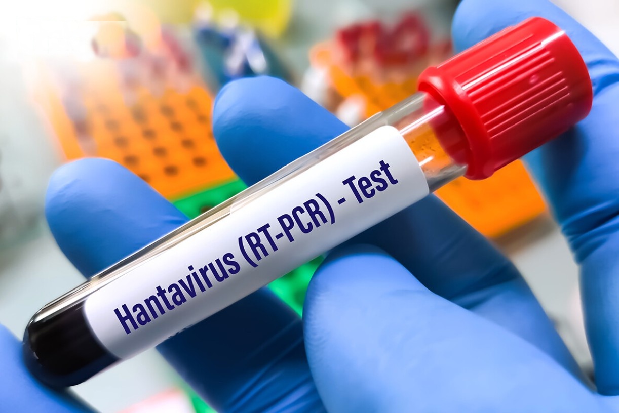 Hanta virus đang trở thành cái tên gây sợ hãi nhất toàn cầu