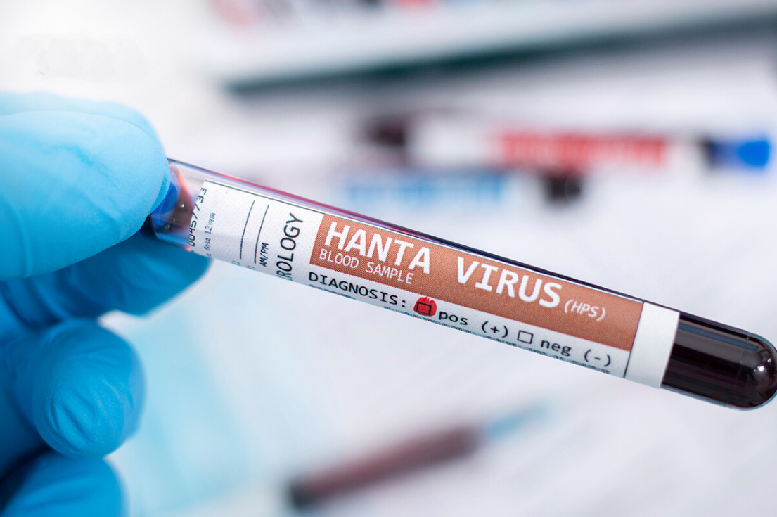Điều đáng sợ ở Virus Hanta: Gây sốt xuất huyết, suy thận chỉ sau vài ngày
