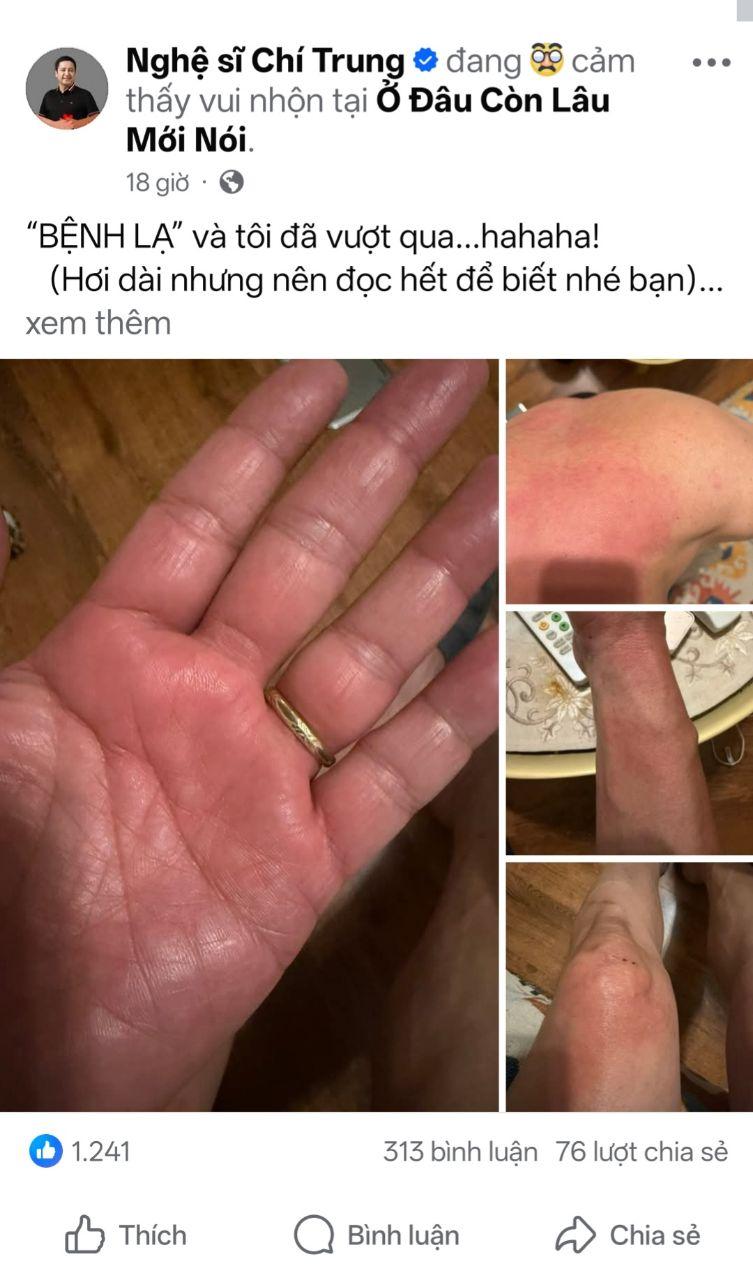 NSƯT Chí Trung chia sẻ về căn bệnh lạ vô tình mắc phải