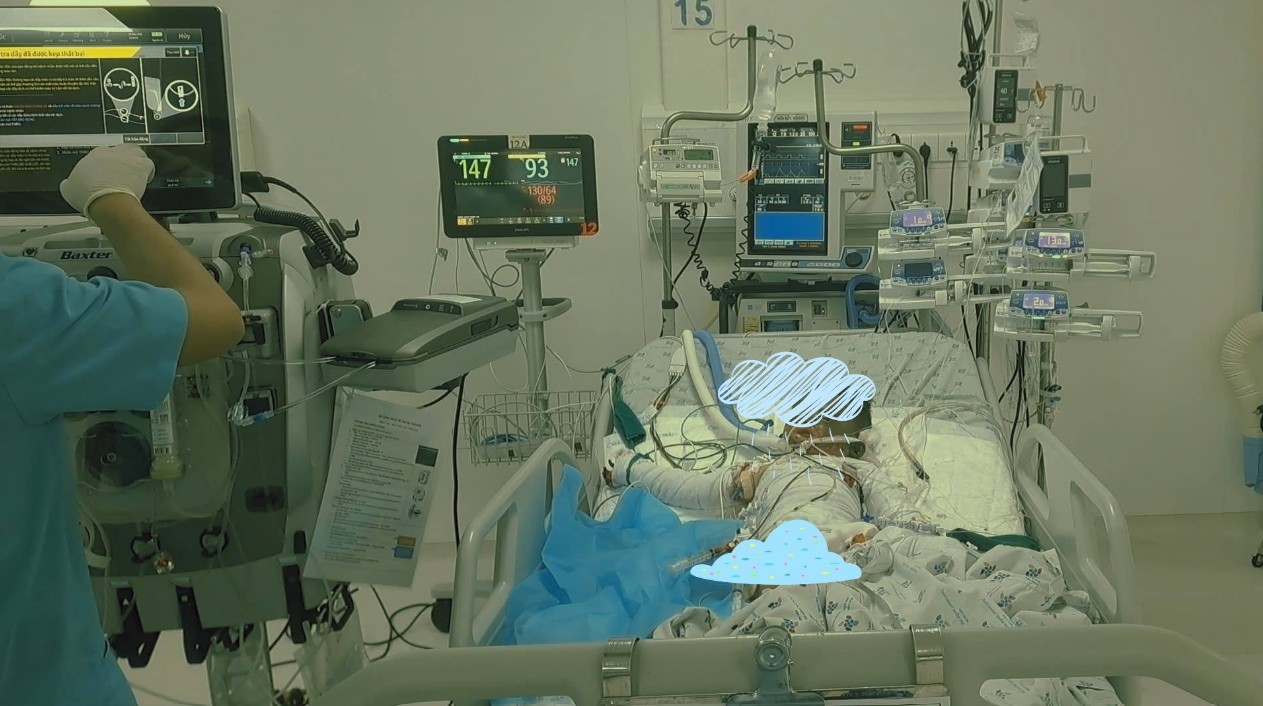 Bé trai 4 tuổi bị bỏng 90% cơ thể