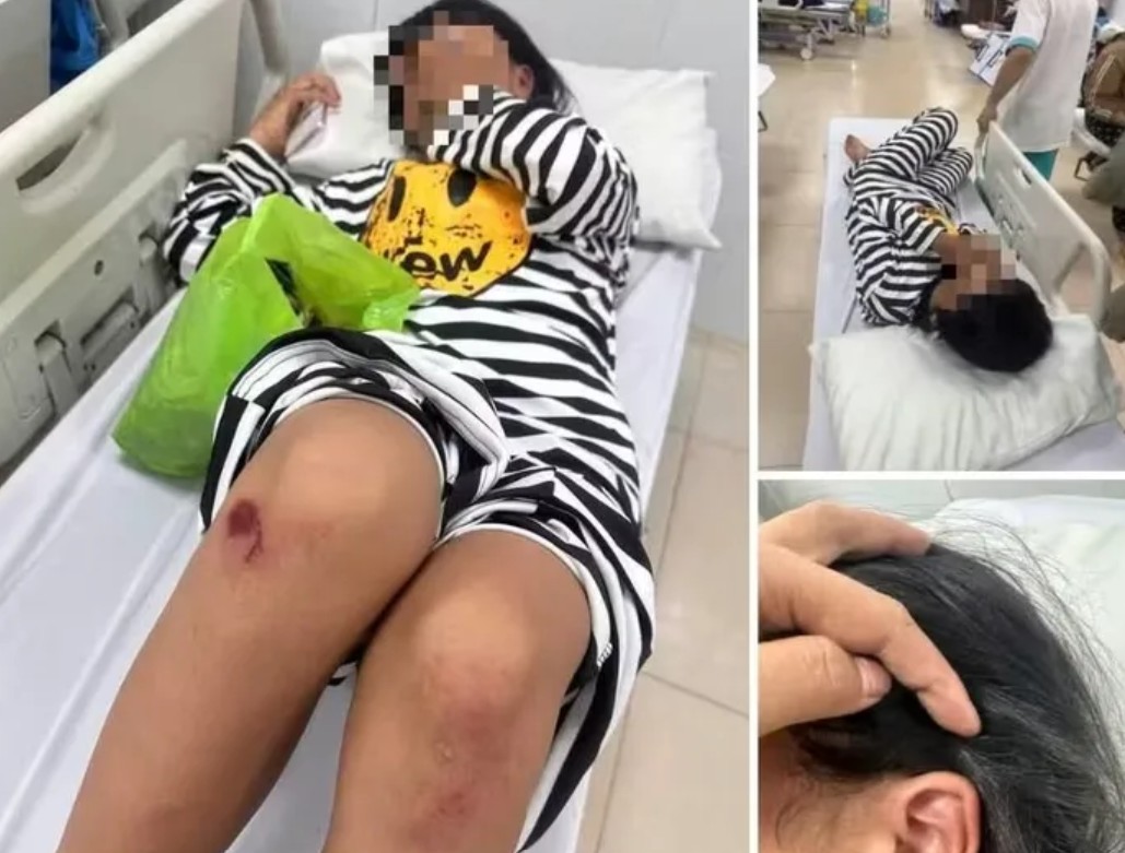 Nữ sinh bị đánh thương nặng phải nhập viện cấp cứu