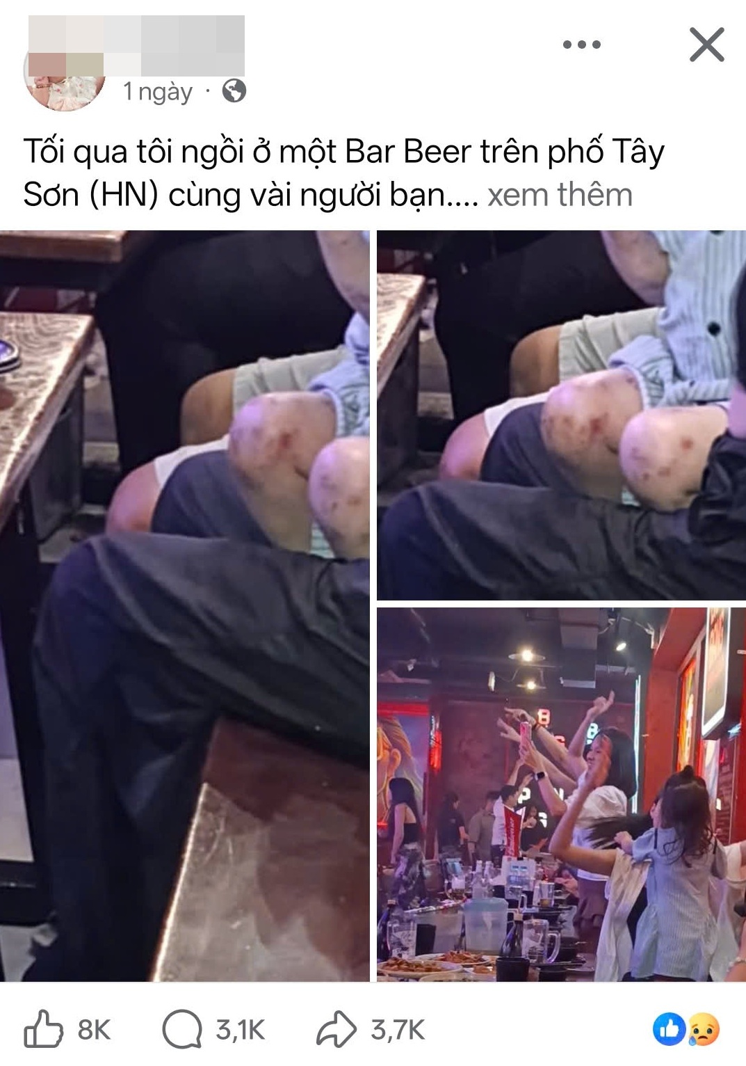 Thông tin cháu bé nghi bị bố mẹ bạo hành do có nhiều vết sẹo ở chân được một tài khoản đăng tải trên mạng