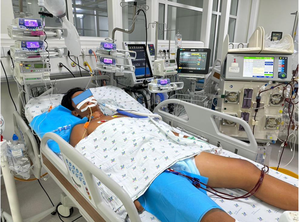 nam sinh sốc nhiệt