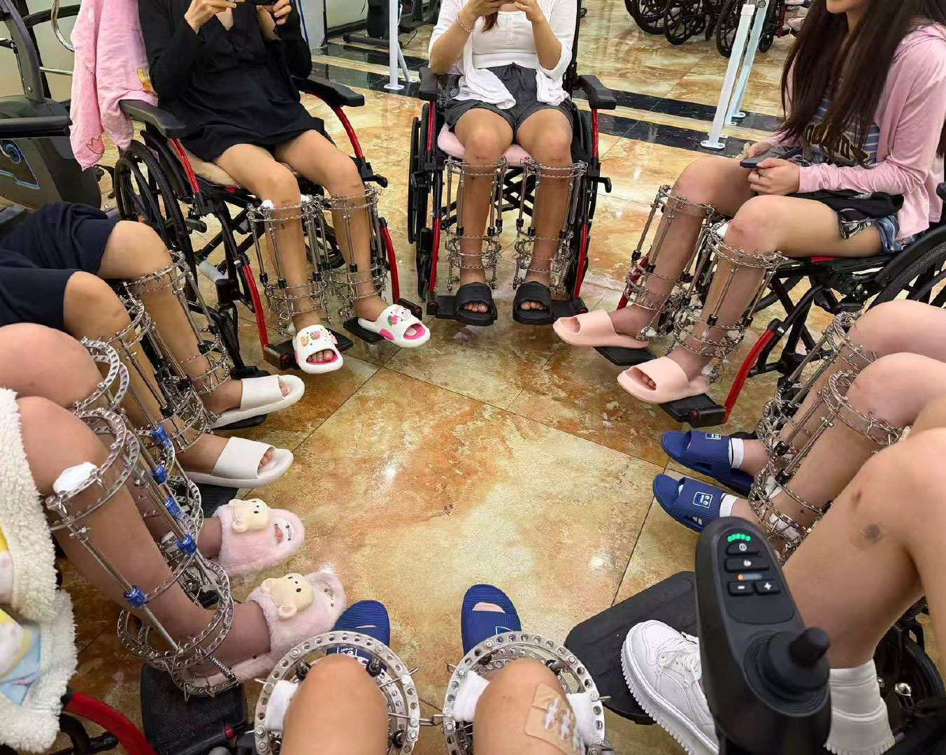 Các bệnh nhân bỏ ra cả tỷ đồng để kéo dài chân, nhưng hậu quả để lại là những biến chứng khủng khiếp