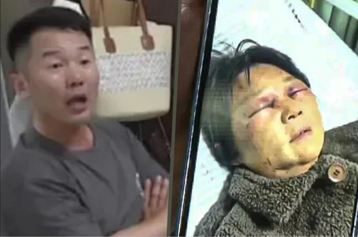 Trong ảnh là bà Shen khi bị con dâu đánh trọng thương và con trai Jiao