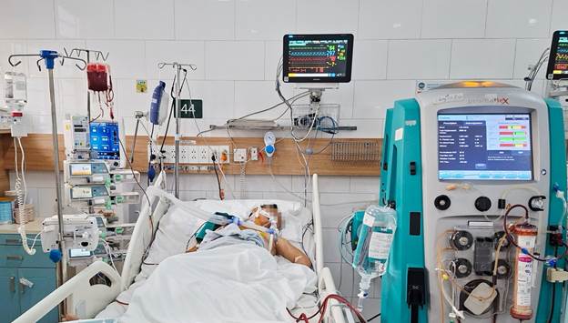 Bệnh nhân phải thở máy, lọc máu liên tục để điều trị tình trạng tan máu cấp nguy kịch. (Ảnh: Bệnh viện Bạch Mai)